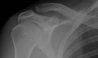 Image Interpretation X-ray Series