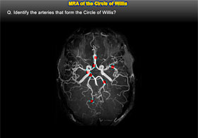 Medical game MRI magnetic resonance imaging