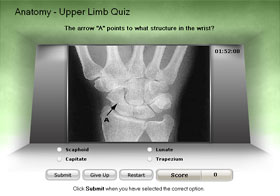 Medical games X-Ray